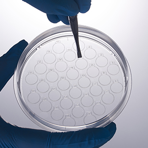 CellSLIP?細胞爬片培養皿,共聚焦培養,細胞爬片